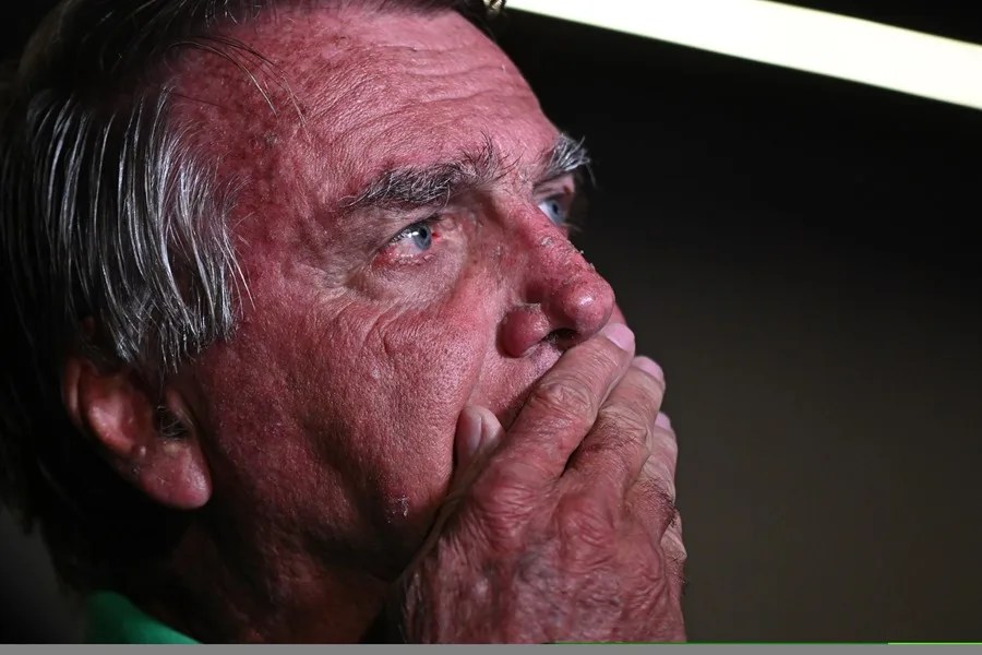 Jair Bolsonaro fue intervenido quirúrgicamente en Brasilia por obstrucción intestinal