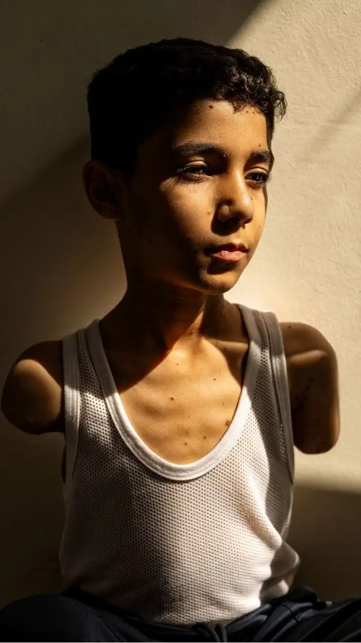 World Press Photo Contest 2025: ganó la foto tomada a un niño mutilado en Gaza